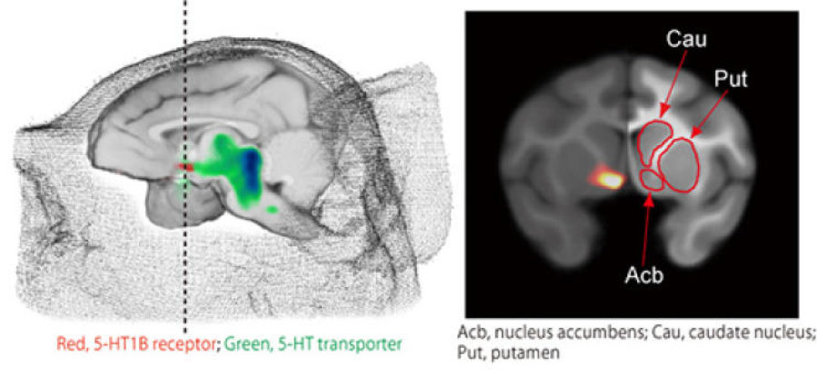 Ketamine Acts as Antidepressant by Boosting Serotonin