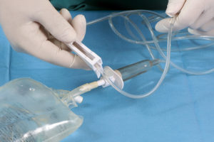Ketamine IV, IM, or IN for depression is the best route for patients with depression.